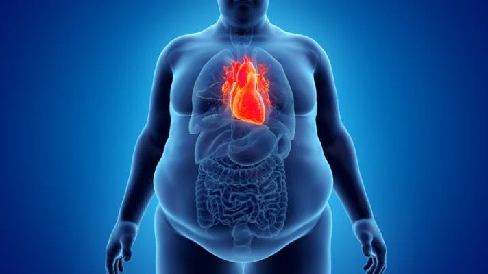 비만(Obesity)