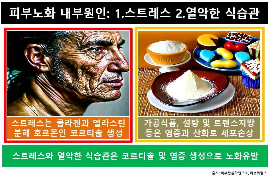 피부노화-내부원인