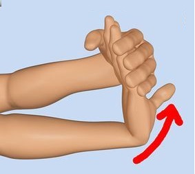 내측상과염 스트레칭