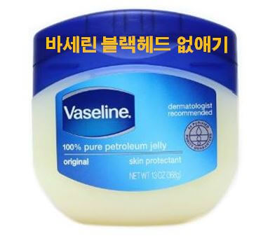 바세린 블랙헤드 없애기