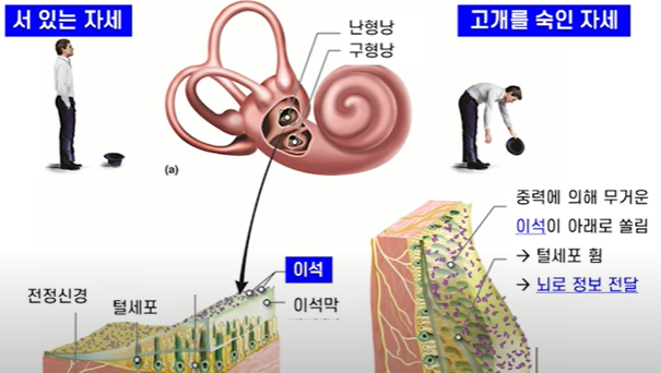 이석증 자가진단 자가치료 방법