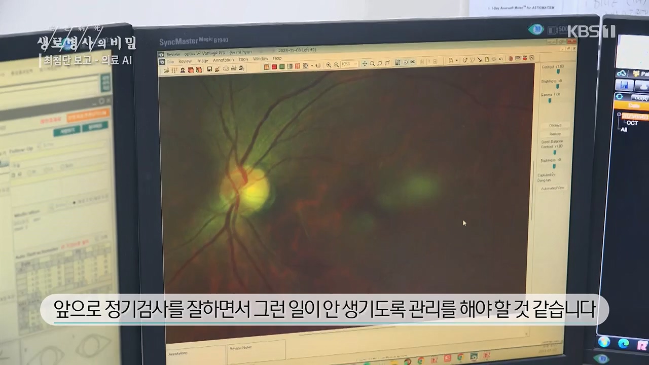 생로병사의 비밀.E869.230518p.H264-F1RST.mp4_20230518_200718.542.jpg