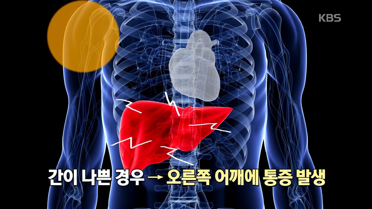 이 이미지는 대체 속성이 비어있습니다. 그 파일 이름은 img.jpg입니다