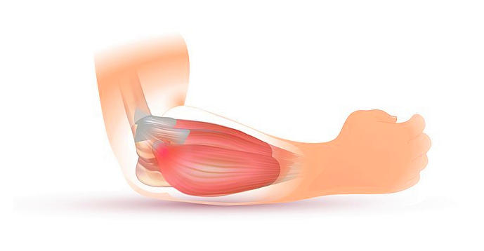  팔꿈치 통증 테니스엘보? 골프엘보? 증상, 원인