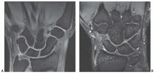 mri1.5t-3t차이영상