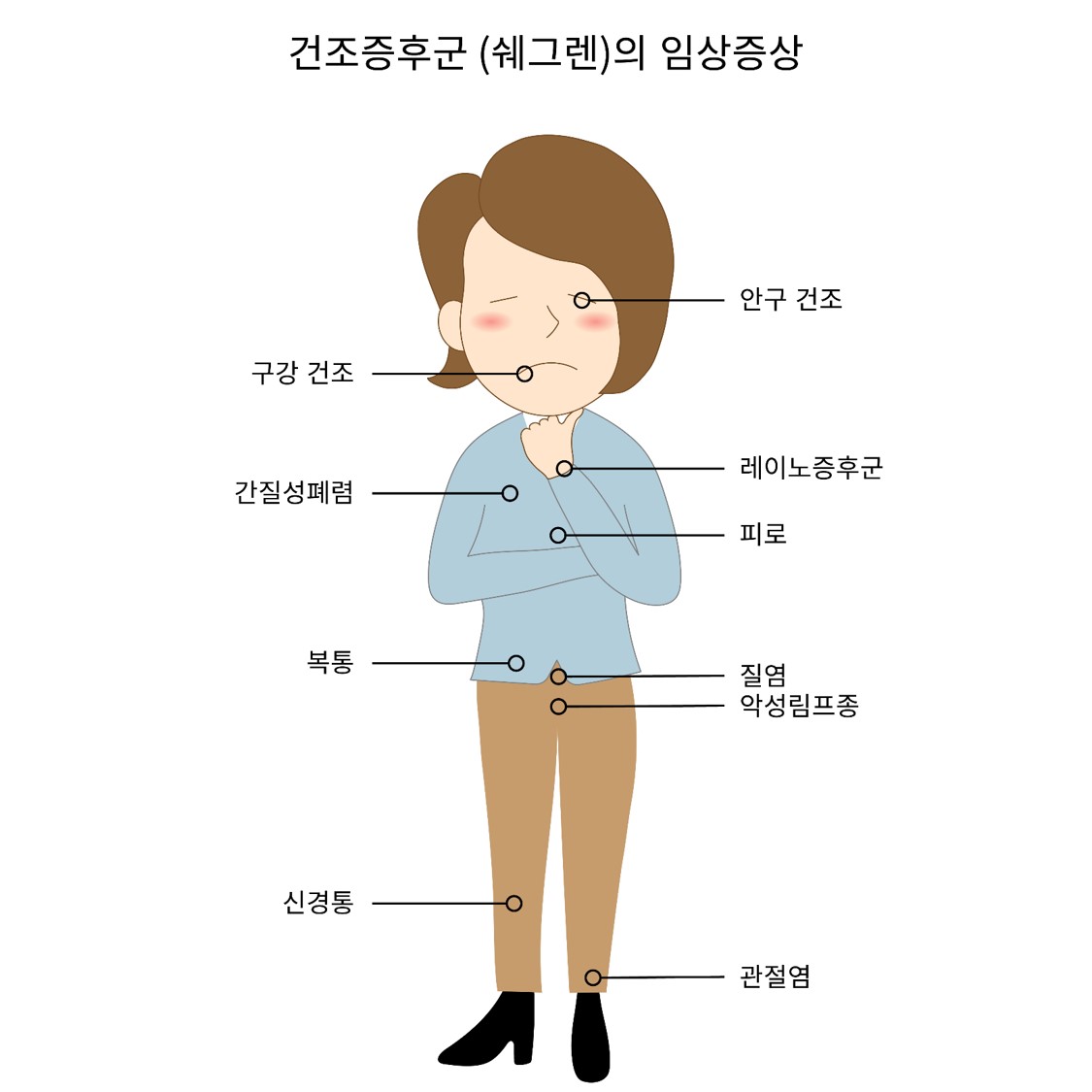  건조증후군[쉐그렌] (Sicca syndrome[Sjogren])