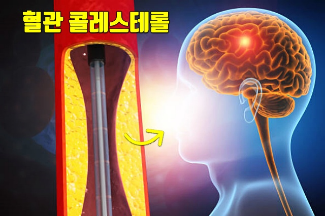 생강차 효능 동맥경화 뇌졸중 예방 음식 생강 효능,건강 팁줌 매일꿀정보