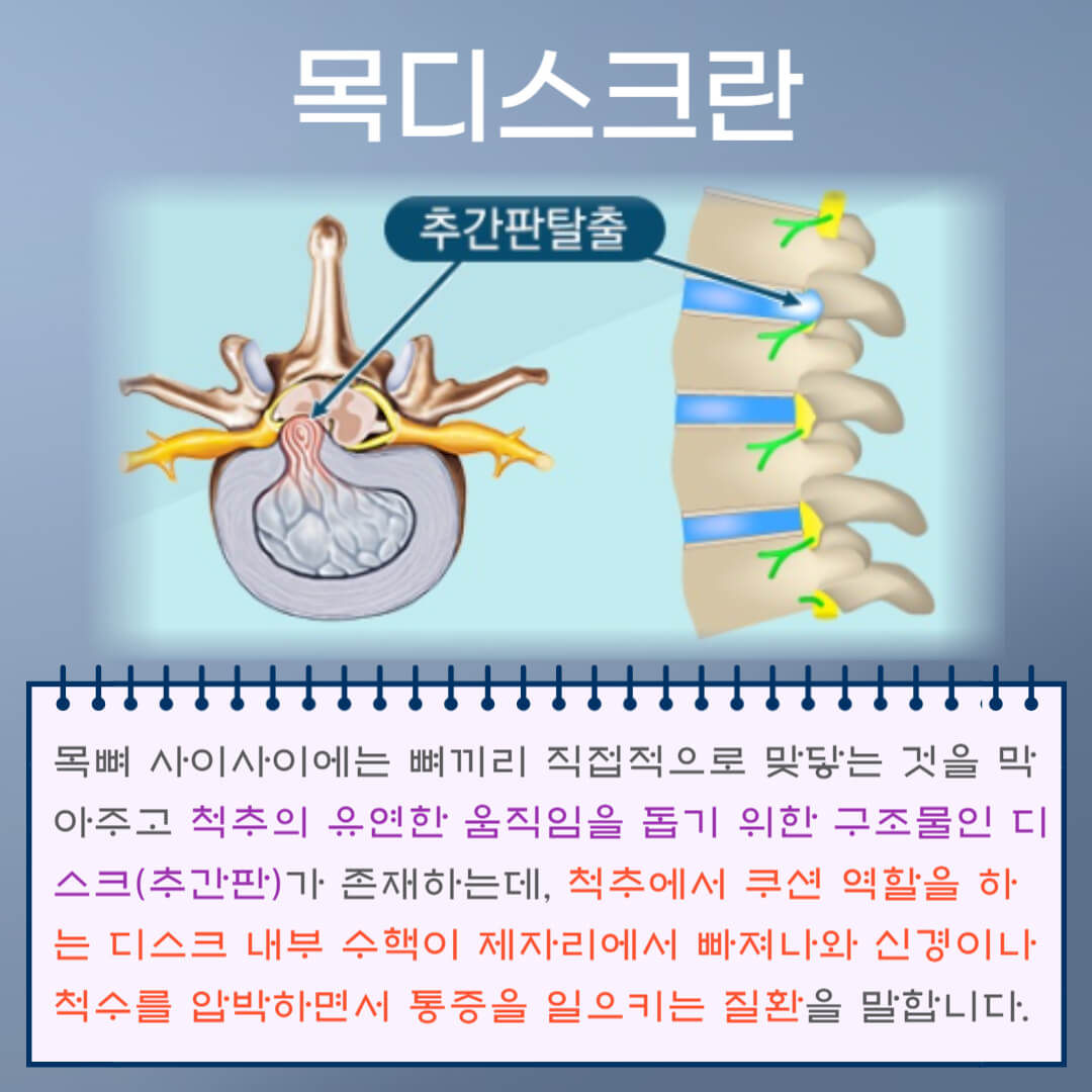 목디스크