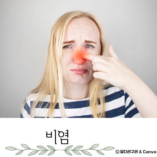 가정용 비염 치료기 추천 치료방법 