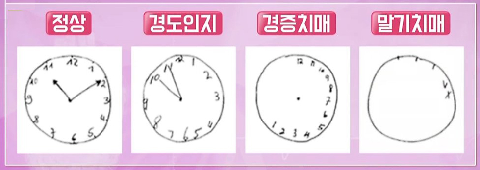  치매 확인, 시계 그리기 검사(Clock Drawing Test)