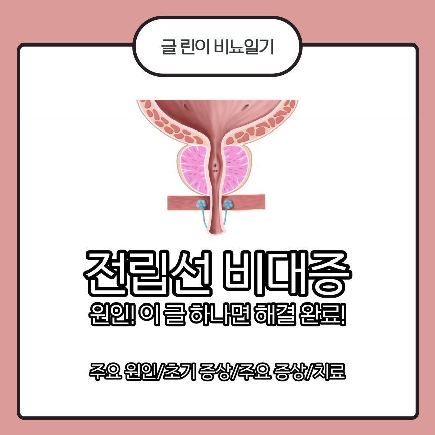  전립선 비대증 원인! 이 글 하나면 해결 완료!