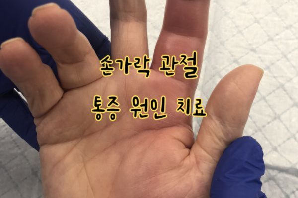 손가락 관절 통증 원인 치료