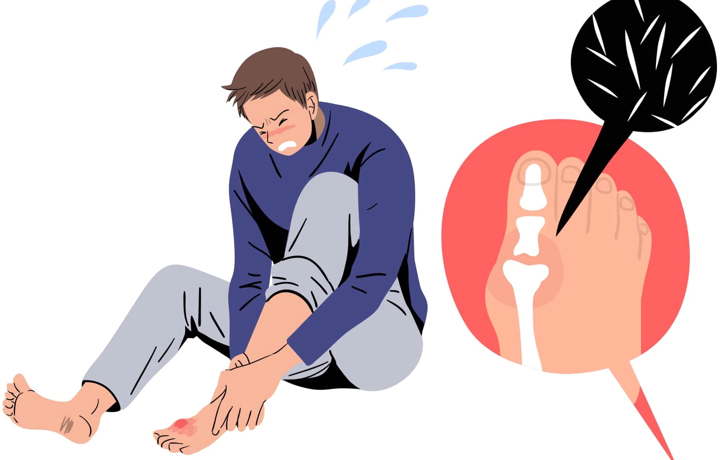 통풍통증