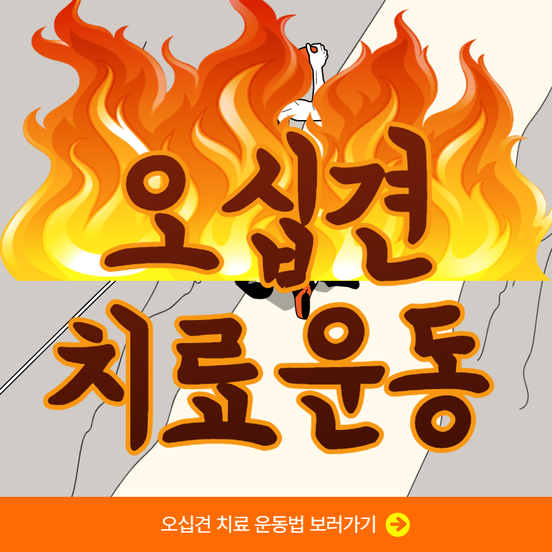 오십견 치료운동법