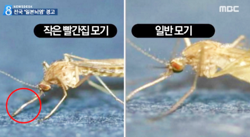  일본뇌염(Japanese encephalitis) 간호