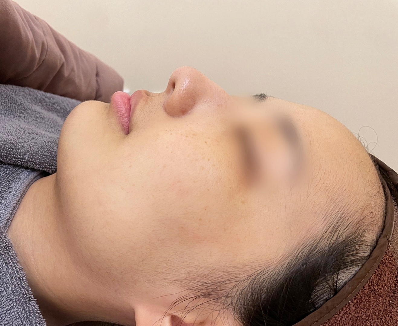 성남피부관리 라이온미 깨끗한 상태를 원한다면