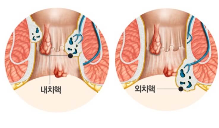 일러스트그림-설명하는그림