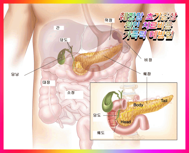 췌장암 초기 증상 원인 비용 가족력 치료병원 (3기, 4기 발생률, 생존율) Pancreatic Cancer Early Symptoms Best Hospitals in Korea
