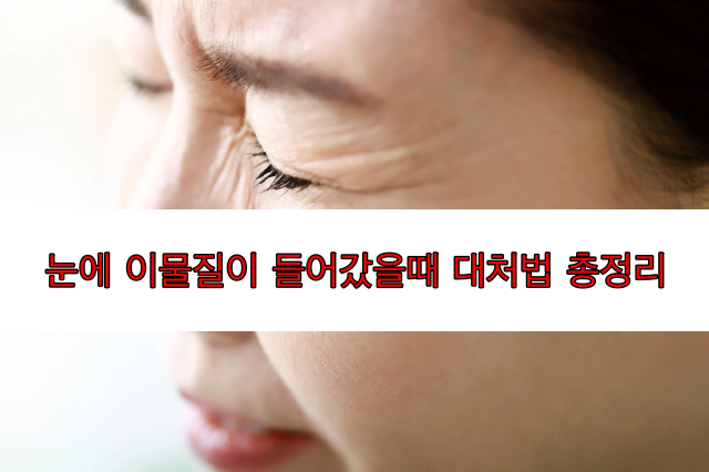  눈에 뭐 들어갔을 때 응급처치방법 5가지 (손소독제,락스,염색약 등이 눈에 들어갔을때)(생활정보)