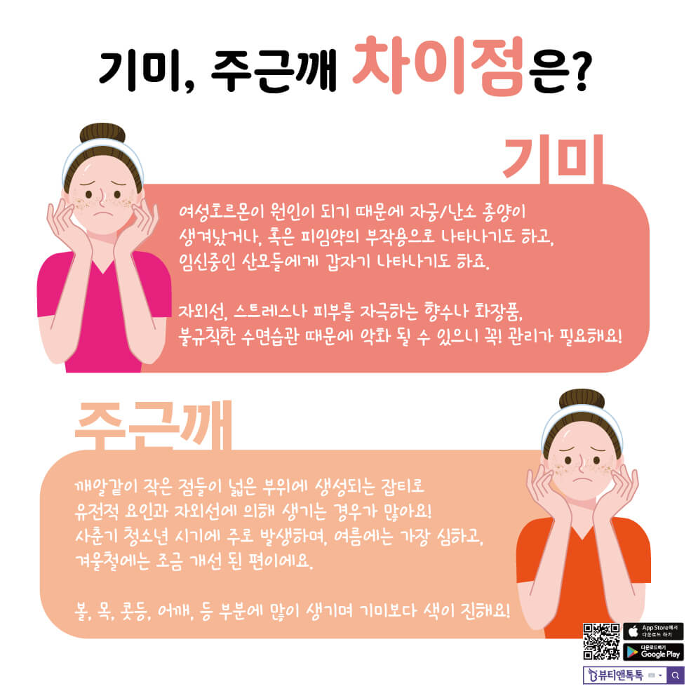 기미와 주근깨 차이