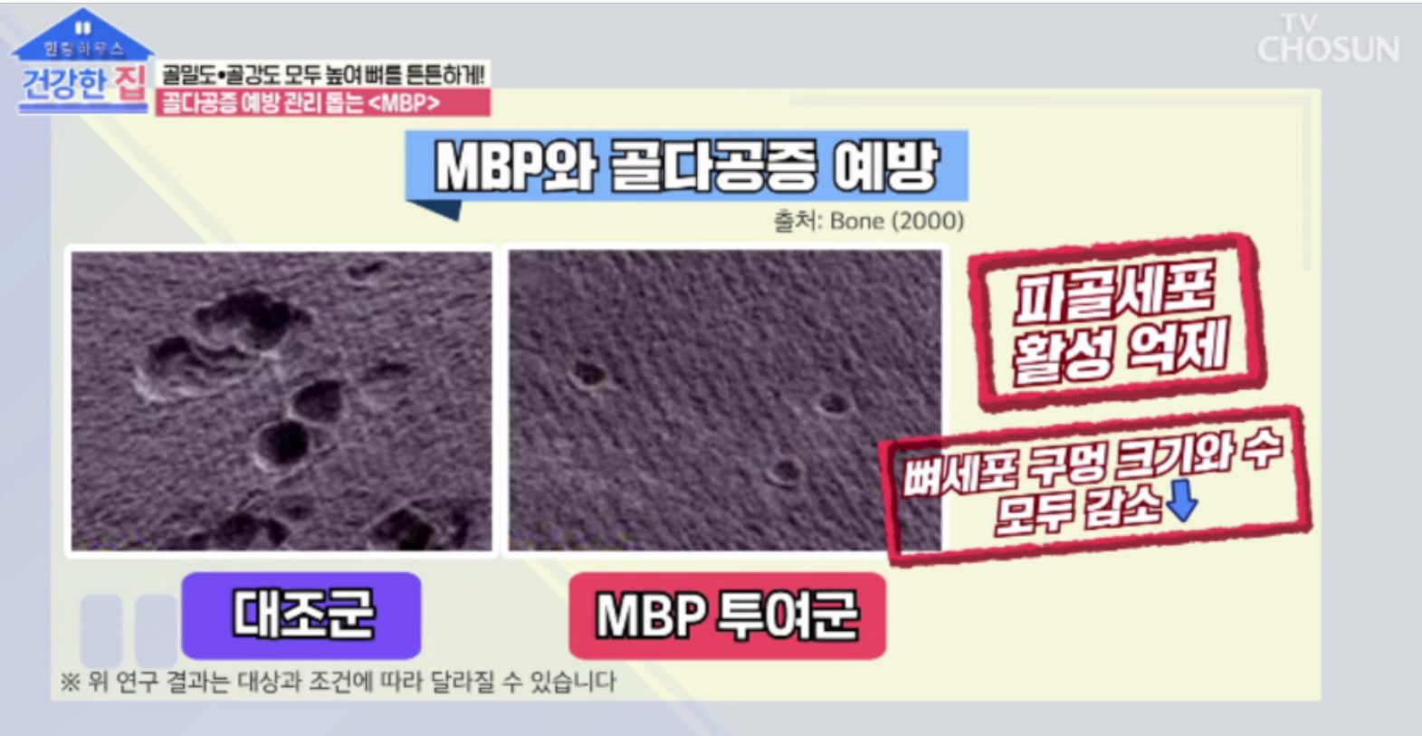 MBP 골밀도 강화