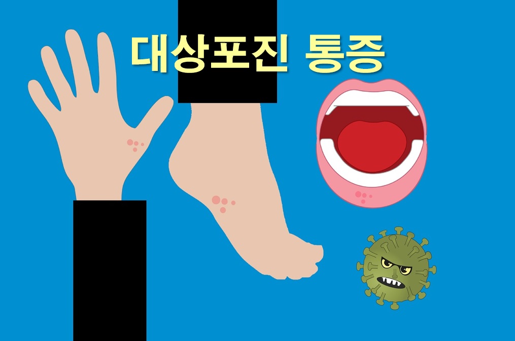  대상포진의 통증 및 감각 이상