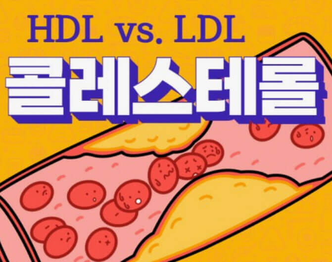HDL-LDL-콜레스테롤
