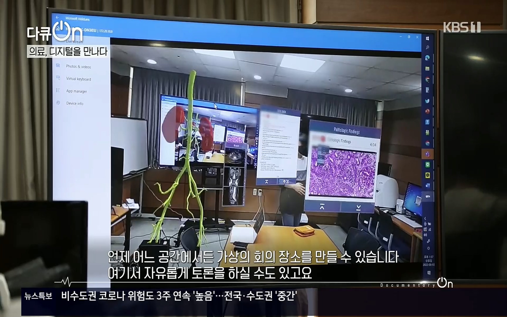 다큐 On.E154p.H264-F1RST.mp4_20220827_180726.746.jpg