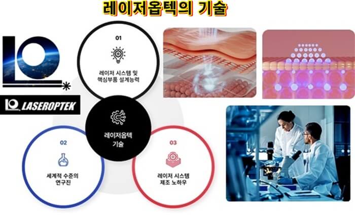 레이저옵텍-기술