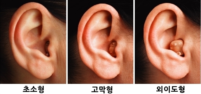 구리 초소형 보청기 나도 쓸 수 있을까?