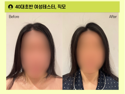 그래비티 탈모 샴푸 최저가 구매