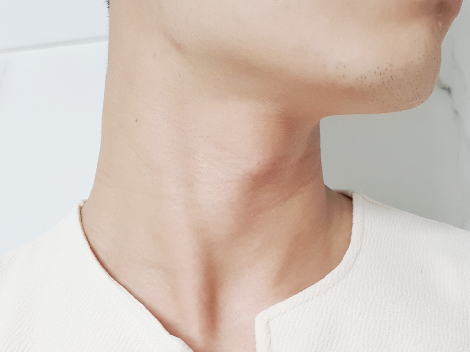 목주름관리법 비오리진 7