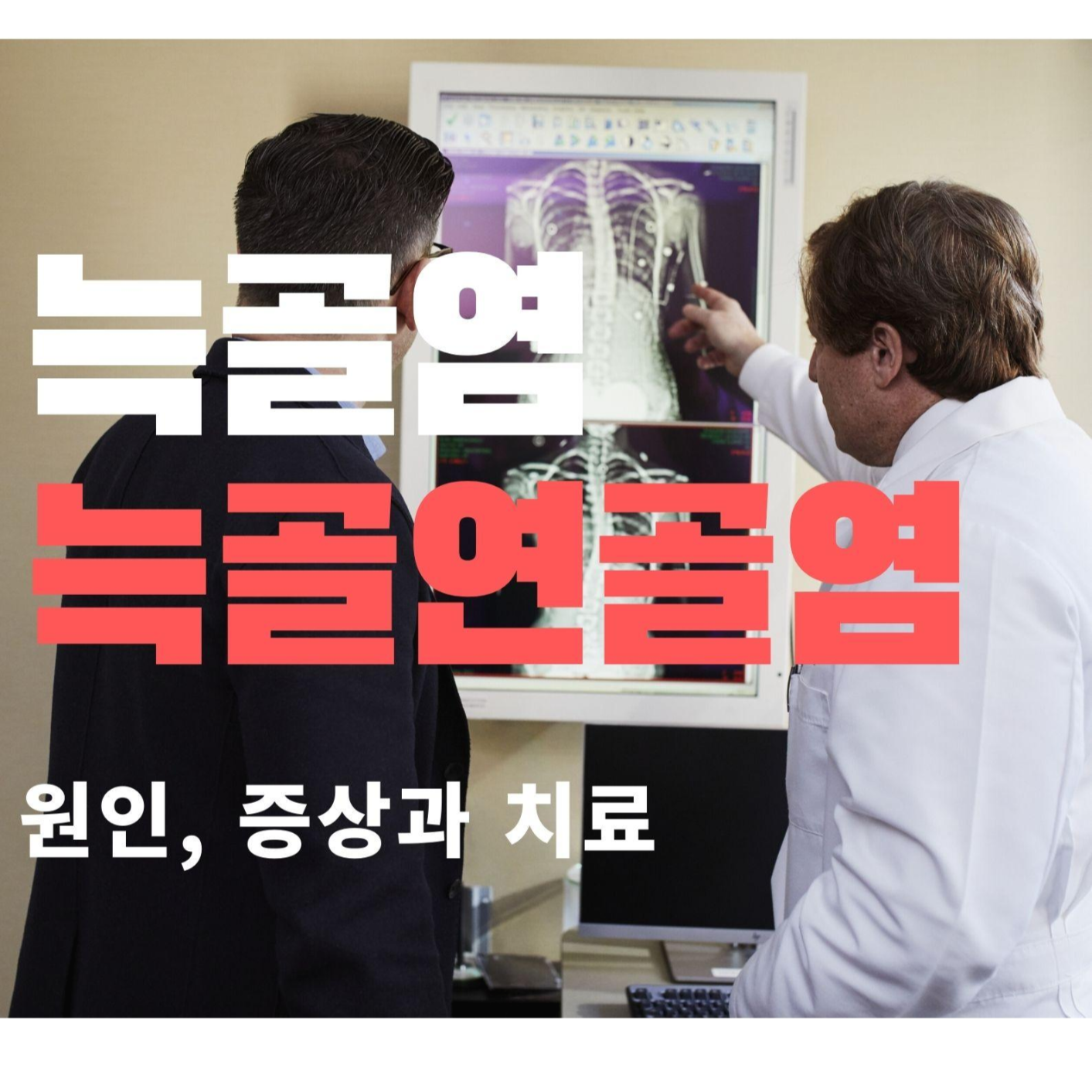  늑골염 늑골연골염이란? 증상과 치료