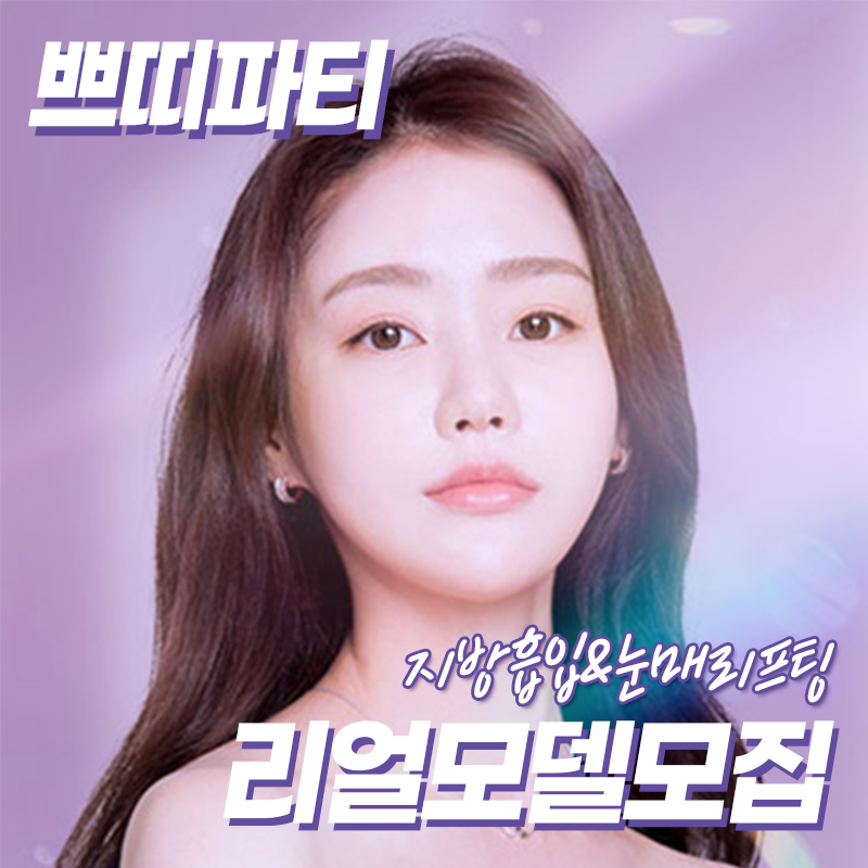  강남 리얼모델모집공고!! 눈매리프팅후기 & 지방흡입전후