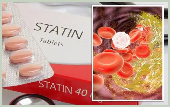 스타틴 고지혈증약 효과