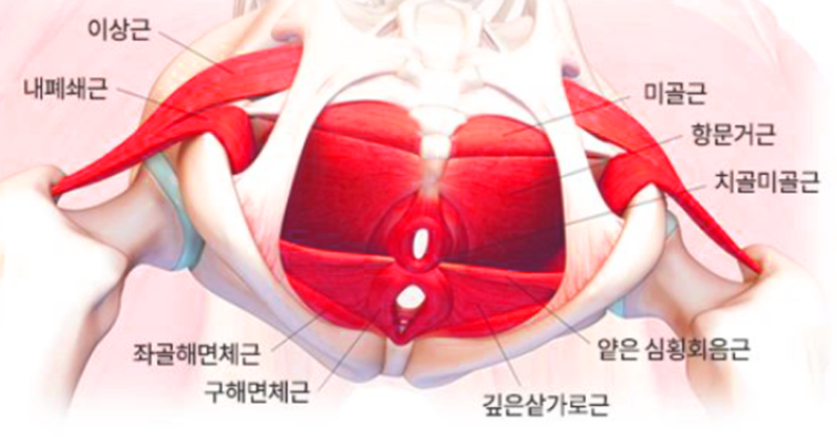 골반 불균형으로 인한 골반기저근 약화