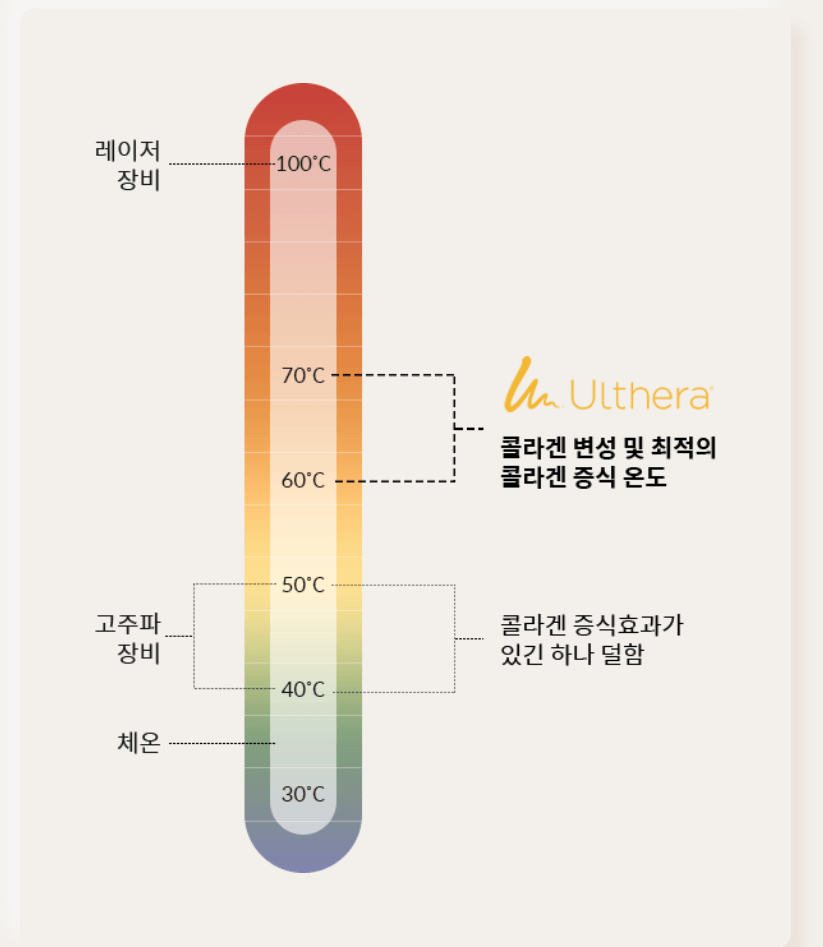 써마지 가격 600샷 효과