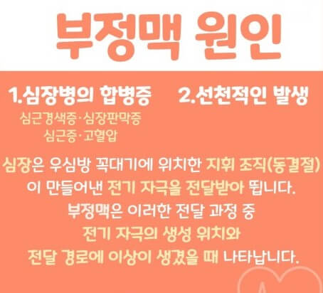 부정맥의 원인