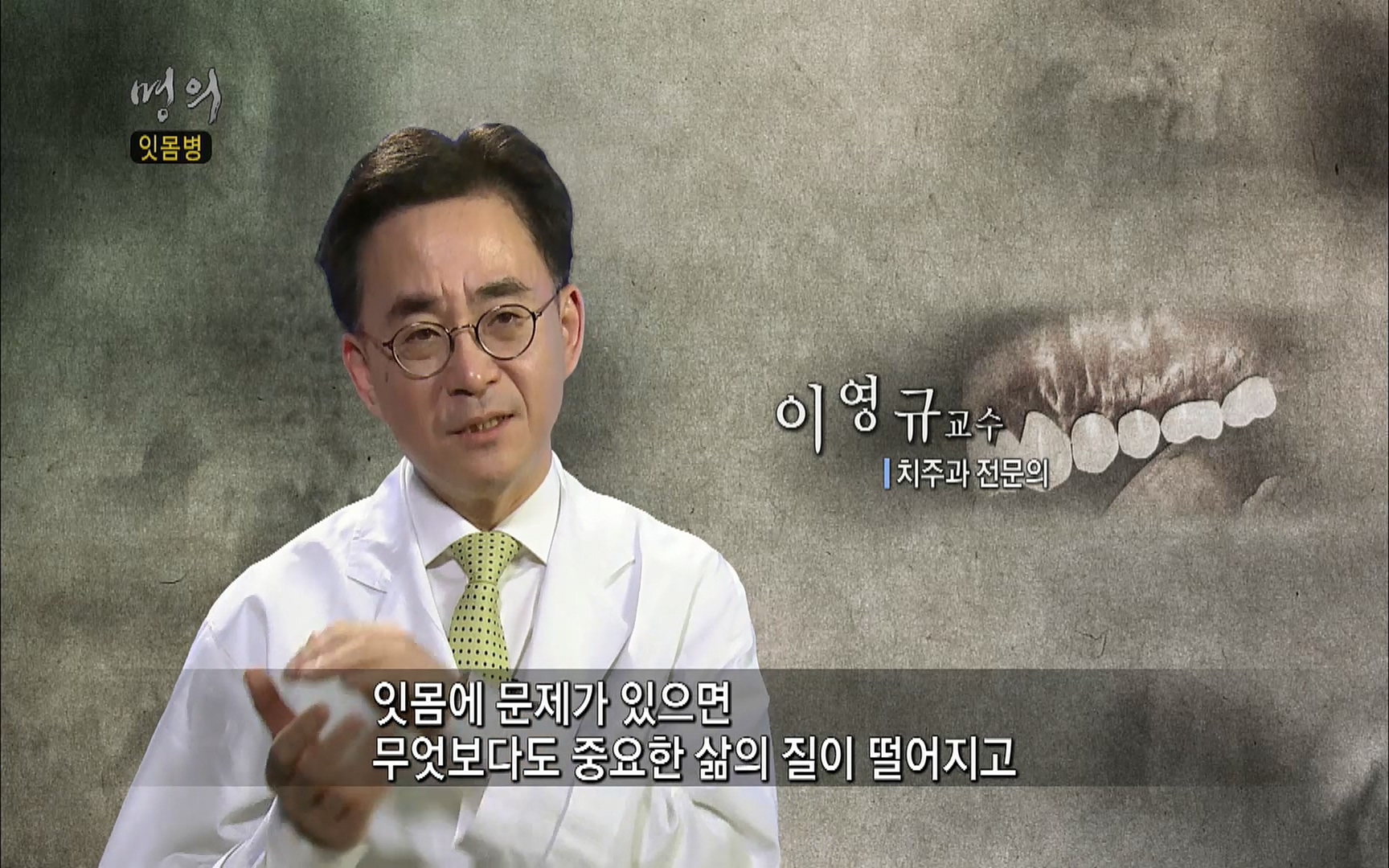 EBS 명의 헬스케어 - TV - 교육의 중심 EBS2015년 1월 16일 (금) 밤 9시 50분, EBS1.mp4_20220505_150314.209.jpg