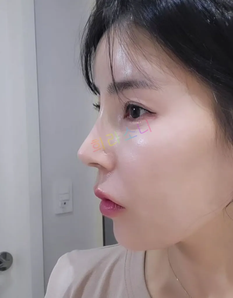 10기 영숙이 측면에서 촬영된 사진. 자연스러운 웨이브 머리를 하고 있으며&amp;#44; 깨끗한 피부와 뚜렷한 이목구비가 강조된다. 배경에는 하얀 문과 스위치가 있으며&amp;#44; 실내 조명이 따뜻하게 비추고 있다. 자막에는 &amp;quot;희라소니&amp;quot;라는 텍스트가 보인다.