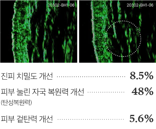 4주 사용으로 인한 피부 탄력 변화