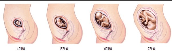 임신초기 증상