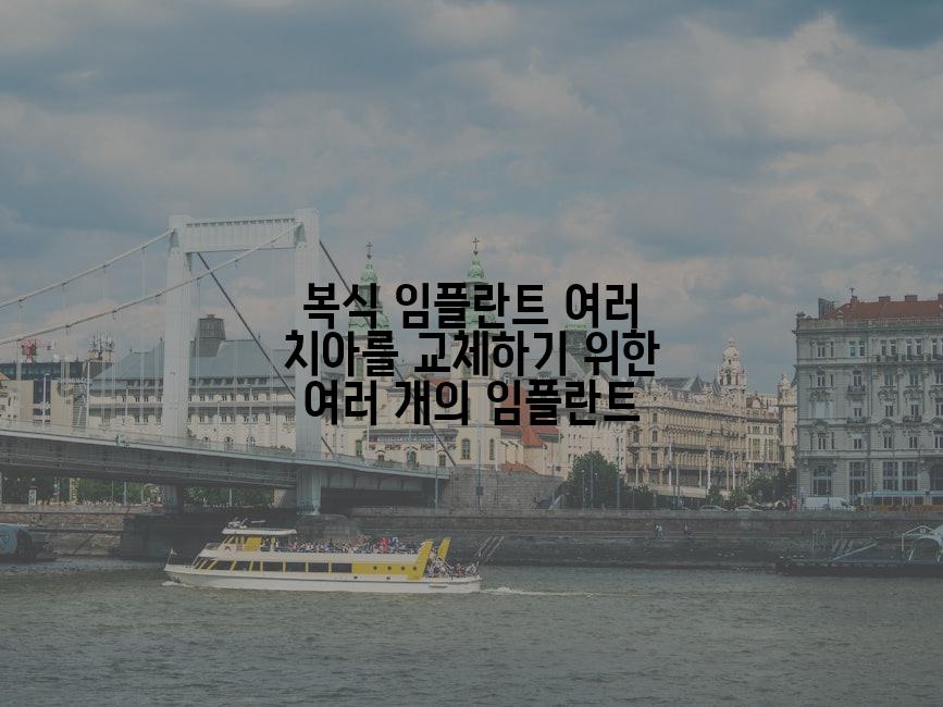 복식 임플란트 여러 치아를 교체하기 위한 여러 개의 임플란트