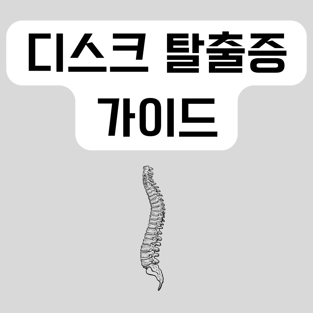 디스크-탈출증