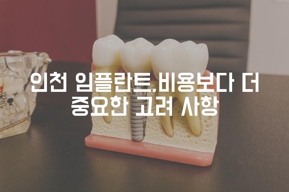 Dental implants 4