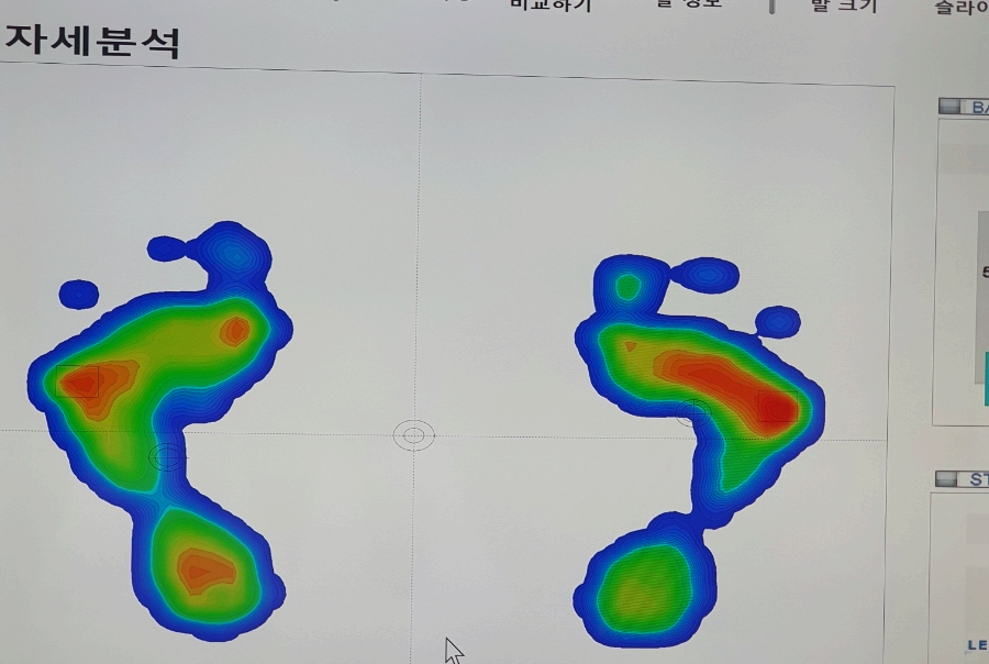 이 이미지는 발바닥의 압력 분포를 시각적으로 나타낸 풋스캔 결과입니다. 왼쪽과 오른쪽 발의 형태가 각각 색상으로 표시되어 있으며, 색상의 변화는 압력의 강도를 의미합니다. 빨간색과 주황색 영역은 발뒤꿈치, 발바닥 중앙, 그리고 엄지발가락 쪽에 집중된 높은 압력을 나타내고, 초록색과 파란색 영역은 압력이 적게 가해지는 부위를 의미합니다. 이미지 상단에는 "자세분석"이라는 한국어 텍스트가 있으며, 이는 아마도 발의 균형이나 체중 분포를 분석하는 목적으로 사용되는 이미지임을 암시합니다.