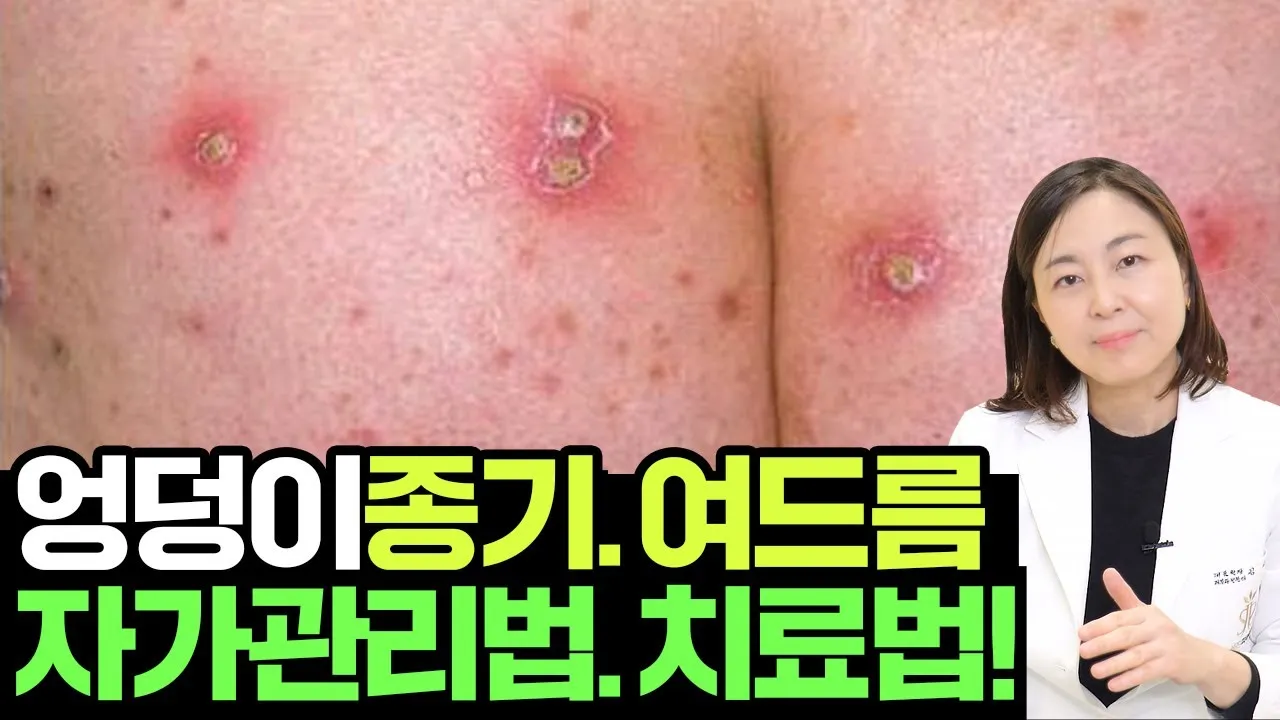 엉덩이 종기가 생기는 이유 왜 생기고 어떻게 관리할까요 완벽 가이드_3