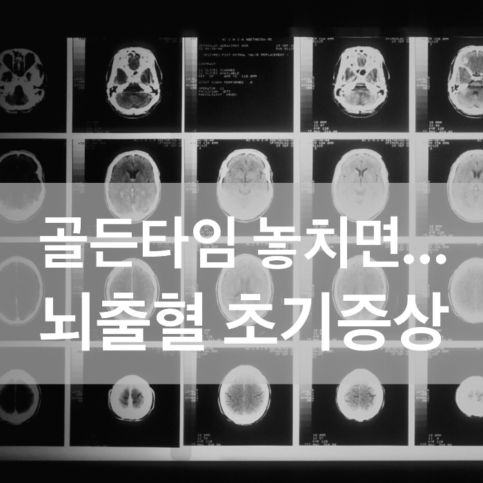  뇌출혈 전조증상 원인 예방 생활수칙