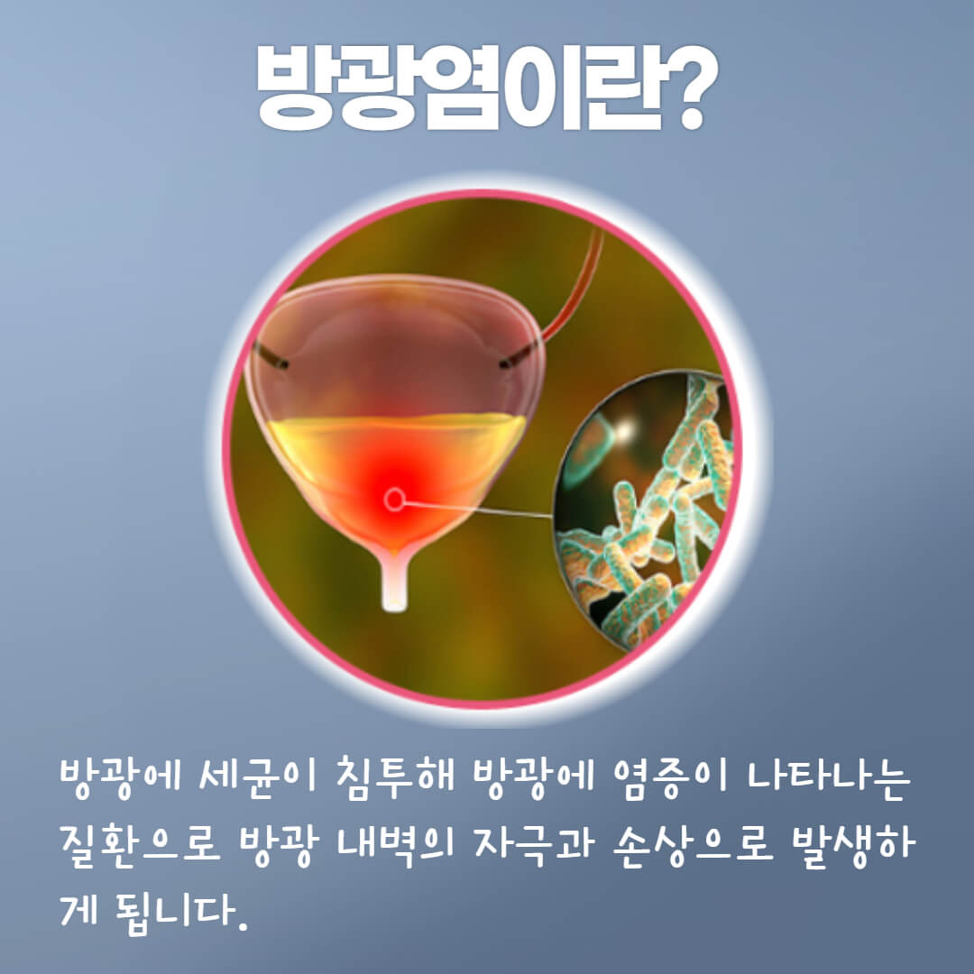 방광염이란