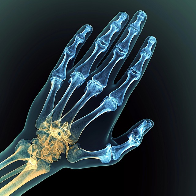 손목 터널 증후군 증상, 원인 및 치료법